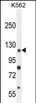 Rabbit Polyclonal Antibody to ANR52  (N-term)
