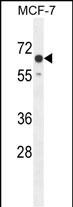 Rabbit Polyclonal Antibody to CO027  (C-term)