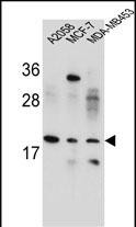 Rabbit Polyclonal Antibody to VCX1  (N-term)