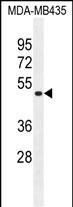 Rabbit Polyclonal Antibody to TAPT1  (C-term)