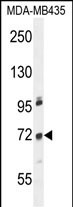 Rabbit Polyclonal Antibody to ZNF510 (N-term)