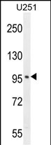 Rabbit Polyclonal Antibody to SOBP