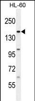 Rabbit Polyclonal Antibody to BCORL1 (N-term)