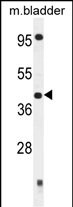 Rabbit Polyclonal Antibody to SLFNL1 (N-term)