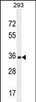 Rabbit Polyclonal Antibody to OR10H1