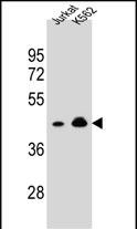 Rabbit Polyclonal Antibody to OR10A4
