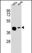 Rabbit Polyclonal Antibody to AMAC1L2 (N-term)