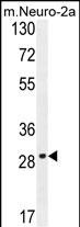 Rabbit Polyclonal Antibody to OR9Q1