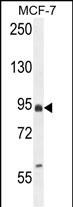 Rabbit Polyclonal Antibody to EFHB (N-term)