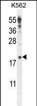 Rabbit Polyclonal Antibody to IQCJ