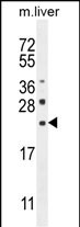 Rabbit Polyclonal Antibody to CLEC2L (N-term)