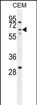 Rabbit Polyclonal Antibody to ZNF674 (N-term)
