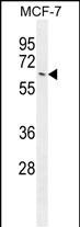 Rabbit Polyclonal Antibody to NKPD1