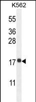 Rabbit Polyclonal Antibody to RPL27A