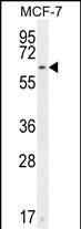 Rabbit Polyclonal Antibody to CTDSPL2 (N-term)