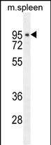 Rabbit Polyclonal Antibody to DTL