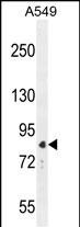 Rabbit Polyclonal Antibody to ANAPC5