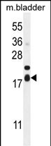 Rabbit Polyclonal Antibody to F162A