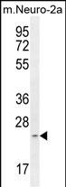 Rabbit Polyclonal Antibody to RT34 (N-term)
