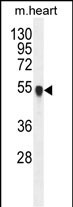 Rabbit Polyclonal Antibody to PPM1L  (C-term)