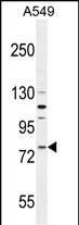 Rabbit Polyclonal Antibody to FZD6