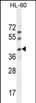 Rabbit Polyclonal Antibody to C17orf59