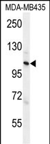 Rabbit Polyclonal Antibody to ZC3H3