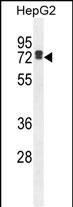 Rabbit Polyclonal Antibody to LRC40  (C-term)