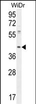 Rabbit Polyclonal Antibody to DUS4L