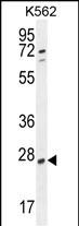 Rabbit Polyclonal Antibody to hCG_2024410