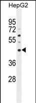 Rabbit Polyclonal Antibody to SATL1