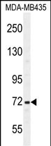 Rabbit Polyclonal Antibody to SRBD1  (C-term)