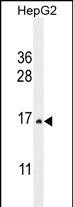 Rabbit Polyclonal Antibody to CST9