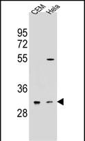 Rabbit Polyclonal Antibody to OR5L2 (N-term)