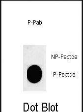 Rabbit Polyclonal Antibody to Phospho-ACTH(S168)