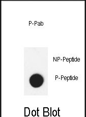 Rabbit Polyclonal Antibody to Cleaved-APG8b    (MAP1LC3B)