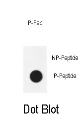 Rabbit Polyclonal Antibody to Phospho-AKT1(T450)