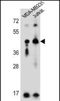 Rabbit Polyclonal Antibody to KIR2DL2