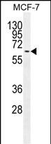 Mouse Monoclonal Antibody to MAPK15