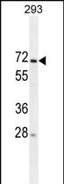Mouse Monoclonal Antibody to MIPEP