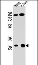 Rabbit Polyclonal Antibody to ETFA
