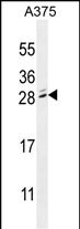 Rabbit Polyclonal Antibody to MBD3L2