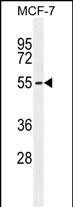 Rabbit Polyclonal Antibody to PMPCA