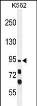 Rabbit Polyclonal Antibody to MYO19