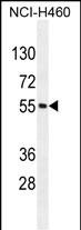 Rabbit Polyclonal Antibody to MIER2 (N-term)
