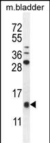 Rabbit Polyclonal Antibody to KTAP2  (C-term)