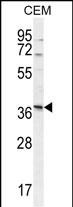 Rabbit Polyclonal Antibody to NXPH4