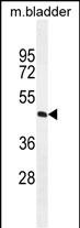 Rabbit Polyclonal Antibody to PPAPDC1A (N-term)