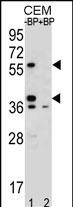 Rabbit Polyclonal Antibody to MNDA (N-term)