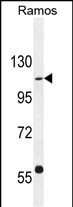 Rabbit Polyclonal Antibody to GIGYF1